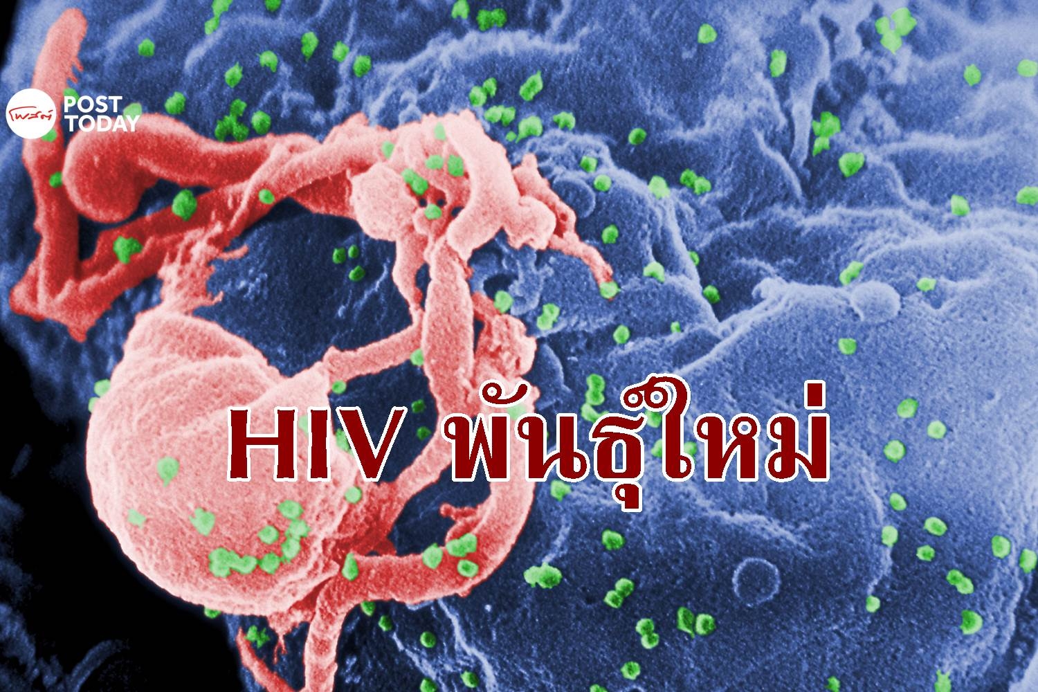 ออกซ์ฟอร์ดพบเชื้อ HIV สายพันธุ์ใหม่ในเนเธอร์แลนด์